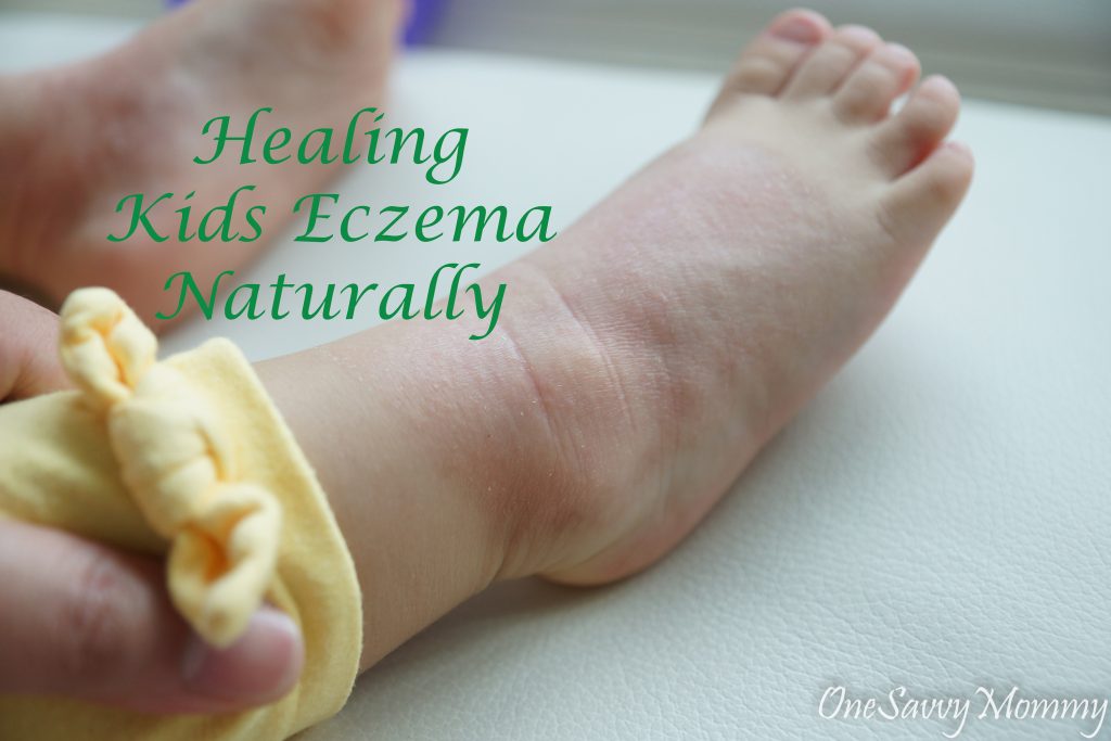 7 Steps in Healing Kids Eczema Naturally